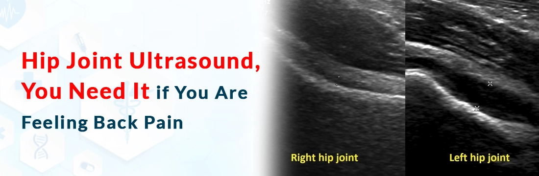 Hip Joint Ultrasound, You Need It, if You Are Feeling Back Pain